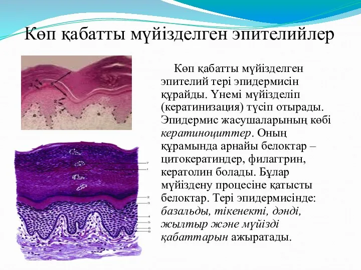 Көп қабатты мүйізделген эпителий тері эпидермисін құрайды. Үнемі мүйізделіп (кератинизация)