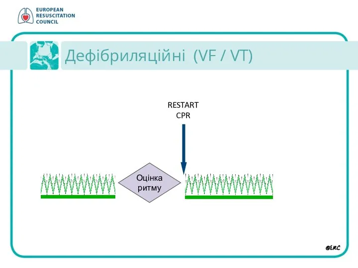 Дефібриляційні (VF / VT)