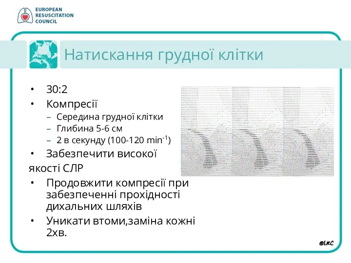 Натискання грудної клітки 30:2 Компресії Середина грудної клітки Глибина 5-6