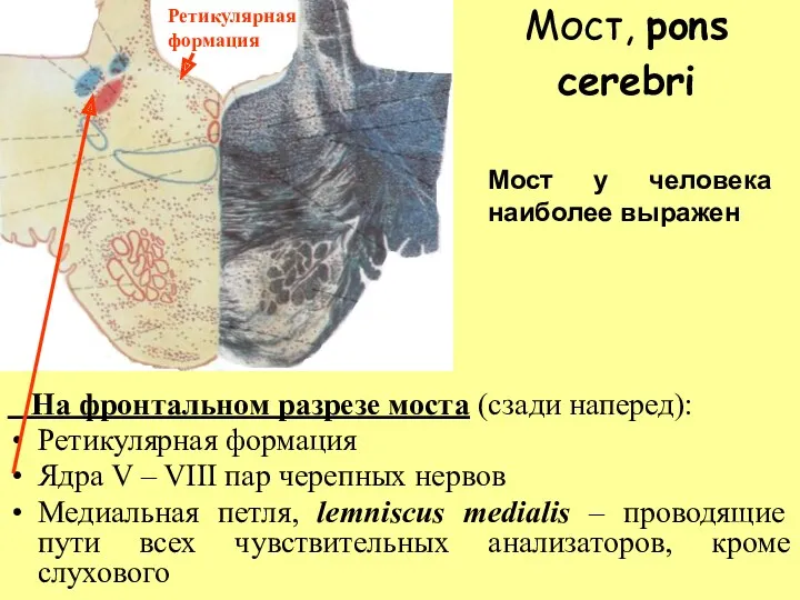 Мост, pons cerebri На фронтальном разрезе моста (сзади наперед): Ретикулярная