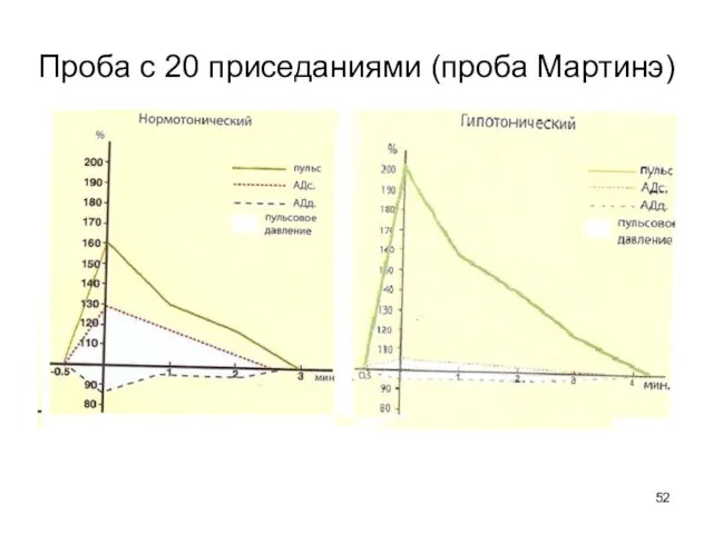 Проба с 20 приседаниями (проба Мартинэ)