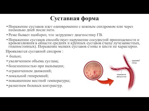 Суставная форма Поражение суставов идет одновременно с кожным синдромом или