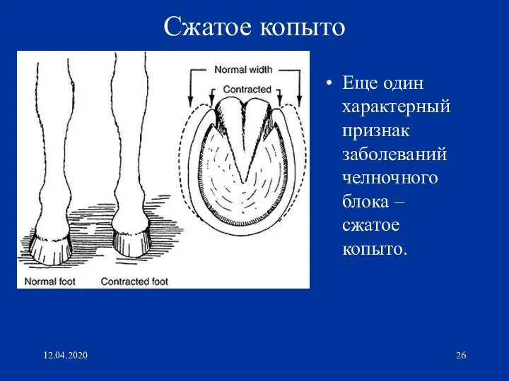 12.04.2020 Сжатое копыто Еще один характерный признак заболеваний челночного блока – сжатое копыто.