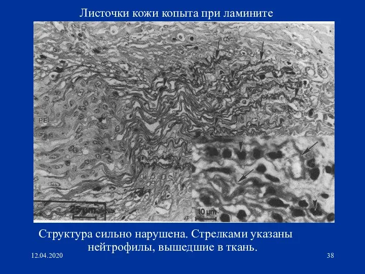 12.04.2020 Листочки кожи копыта при ламините Структура сильно нарушена. Стрелками указаны нейтрофилы, вышедшие в ткань.