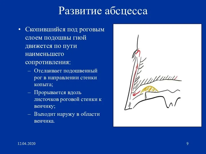 12.04.2020 Развитие абсцесса Скопившийся под роговым слоем подошвы гной движется