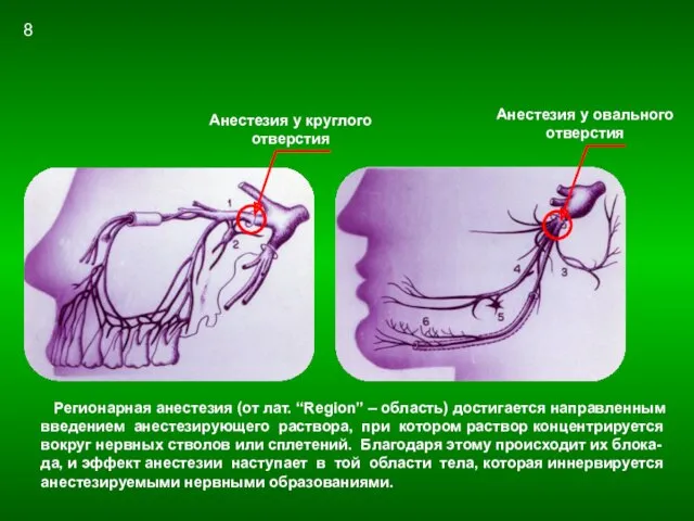 Регионарная анестезия Анестезия у круглого отверстия Анестезия у овального отверстия
