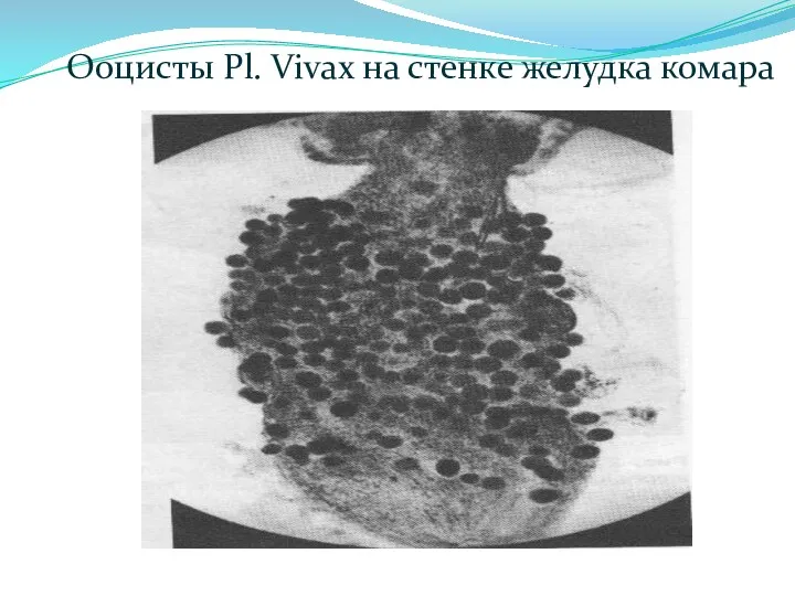 Ооцисты Pl. Vivax на стенке желудка комара