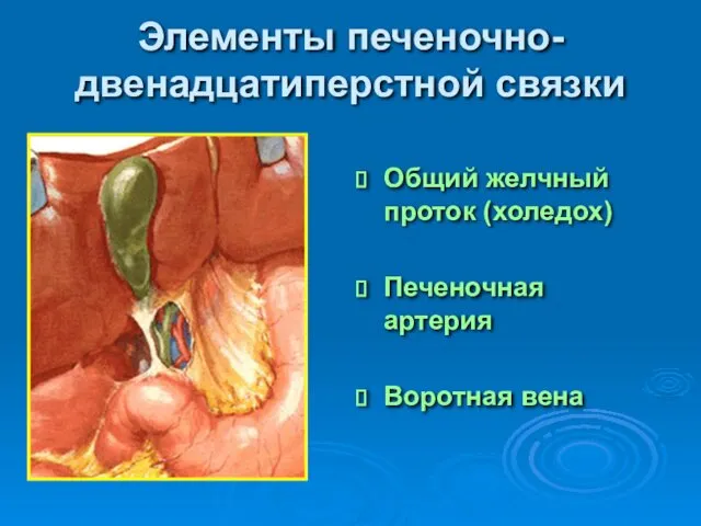 Элементы печеночно-двенадцатиперстной связки Общий желчный проток (холедох) Печеночная артерия Воротная вена