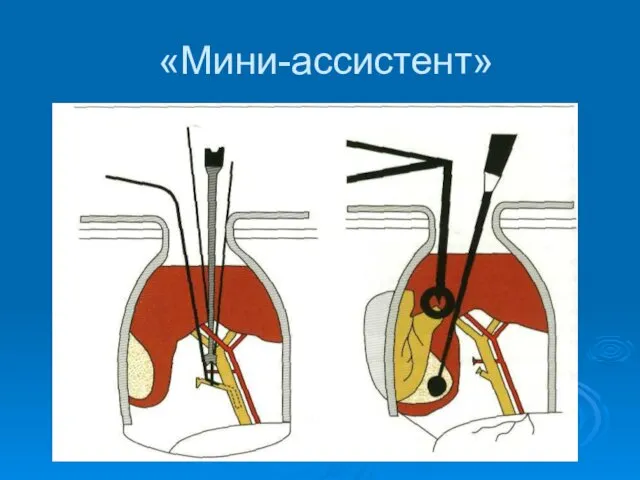 «Мини-ассистент»