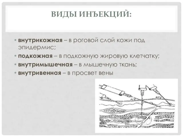 ВИДЫ ИНЪЕКЦИЙ: внутрикожная – в роговой слой кожи под эпидермис;