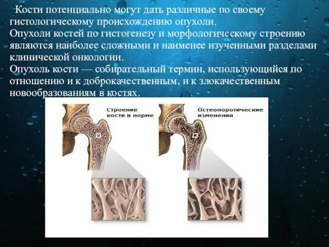 Кости потенциально могут дать различные по своему гистологическому происхождению опухоли.