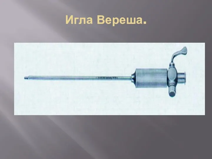 Игла Вереша.