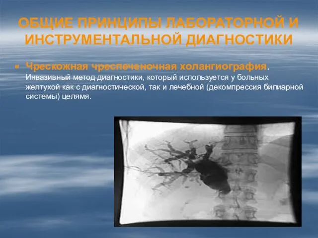 ОБЩИЕ ПРИНЦИПЫ ЛАБОРАТОРНОЙ И ИНСТРУМЕНТАЛЬНОЙ ДИАГНОСТИКИ Чрескожная чреспеченочная холангиография. Инвазивный