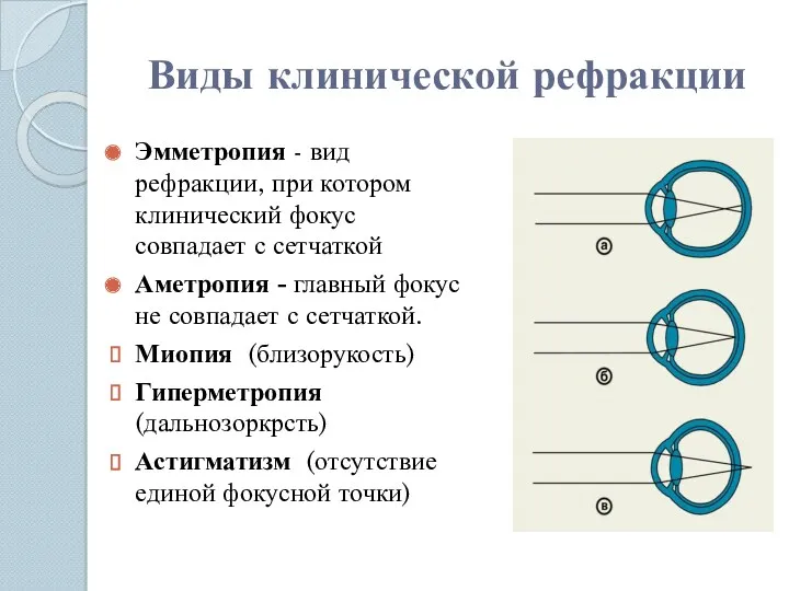 Виды клинической рефракции Эмметропия - вид рефракции, при котором клинический