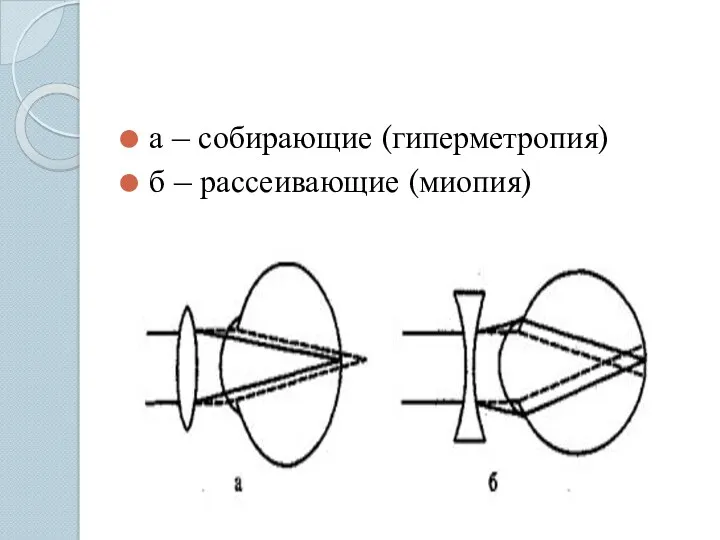 а – собирающие (гиперметропия) б – рассеивающие (миопия)