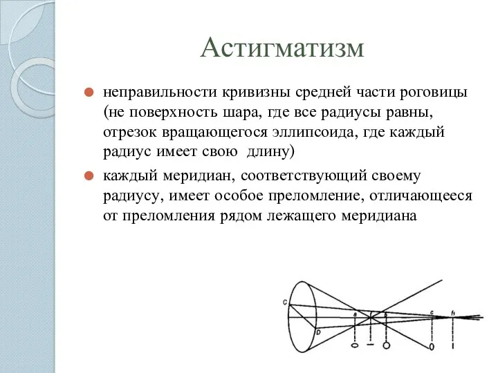 Астигматизм неправильности кривизны средней части роговицы (не поверхность шара, где