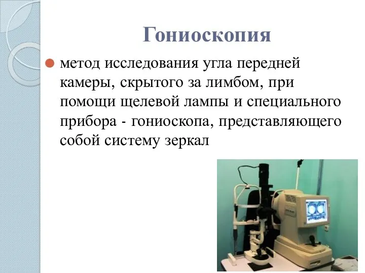 Гониоскопия метод исследования угла передней камеры, скрытого за лимбом, при