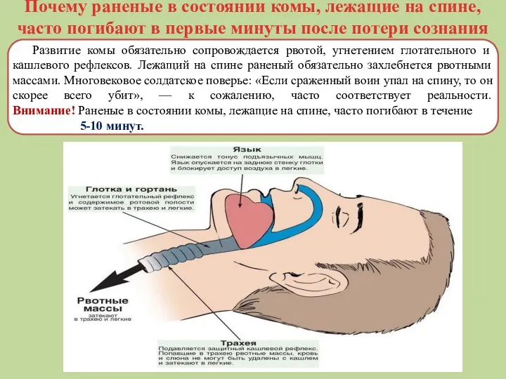 Почему раненые в состоянии комы, лежащие на спине, часто погибают