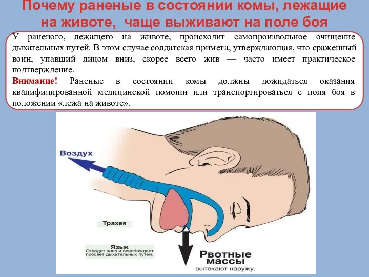 Почему раненые в состоянии комы, лежащие на животе, чаще выживают