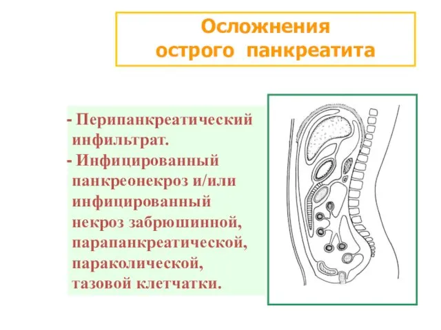 Осложнения острого панкреатита Перипанкреатический инфильтрат. Инфицированный панкреонекроз и/или инфицированный некроз забрюшинной, парапанкреатической, параколической, тазовой клетчатки.