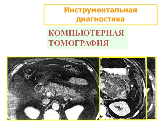 Инструментальная диагностика КОМПЬЮТЕРНАЯ ТОМОГРАФИЯ