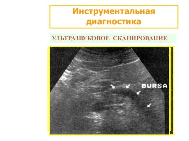 Инструментальная диагностика УЛЬТРАЗВУКОВОЕ СКАНИРОВАНИЕ