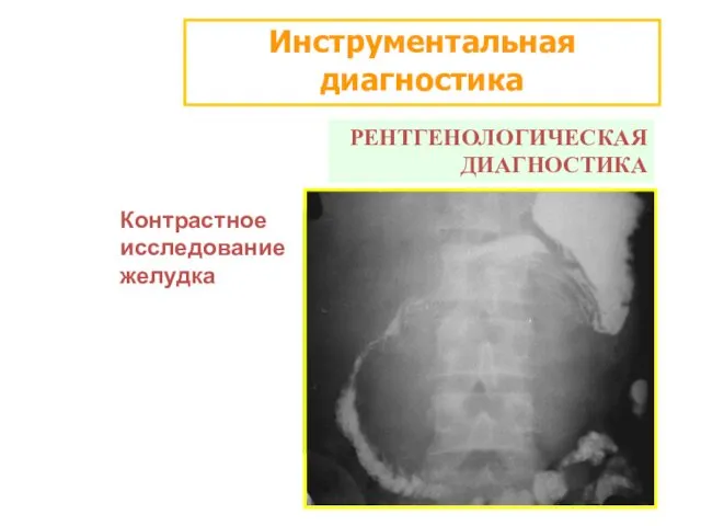 Инструментальная диагностика РЕНТГЕНОЛОГИЧЕСКАЯ ДИАГНОСТИКА Контрастное исследование желудка