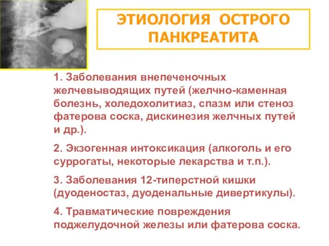 ЭТИОЛОГИЯ ОСТРОГО ПАНКРЕАТИТА 1. Заболевания внепеченочных желчевыводящих путей (желчно-каменная болезнь,