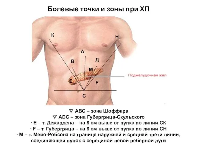 Болевые точки и зоны при ХП ∇ АВС – зона