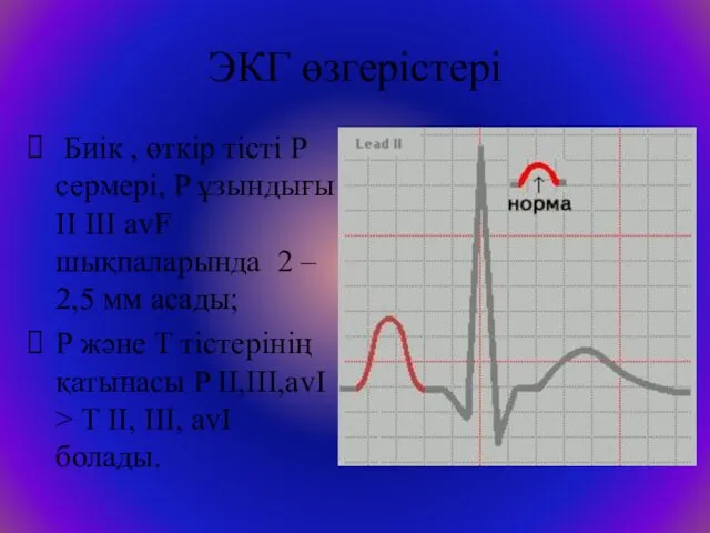 ЭКГ өзгерістері Биік , өткір тісті P сермері, P ұзындығы