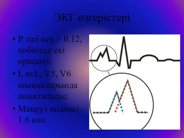 ЭКГ өзгерістері Р тісі кең > 0.12, көбінесе екі өркешті;