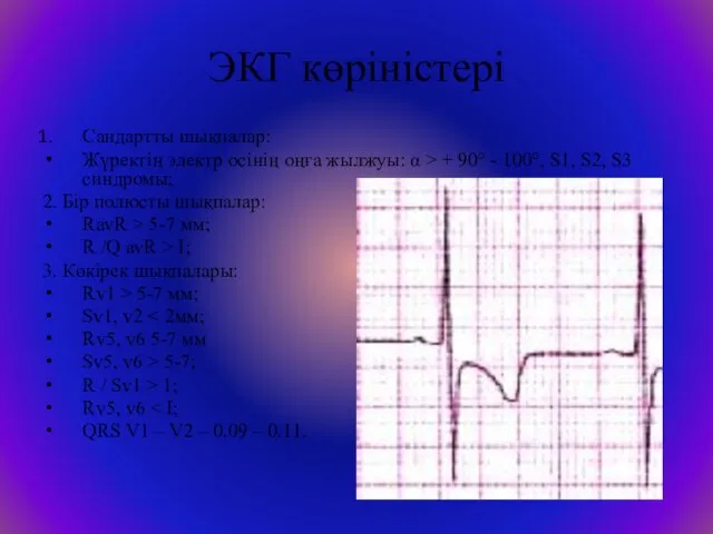 ЭКГ көріністері Сандартты шықпалар: Жүректің электр осінің оңға жылжуы: α