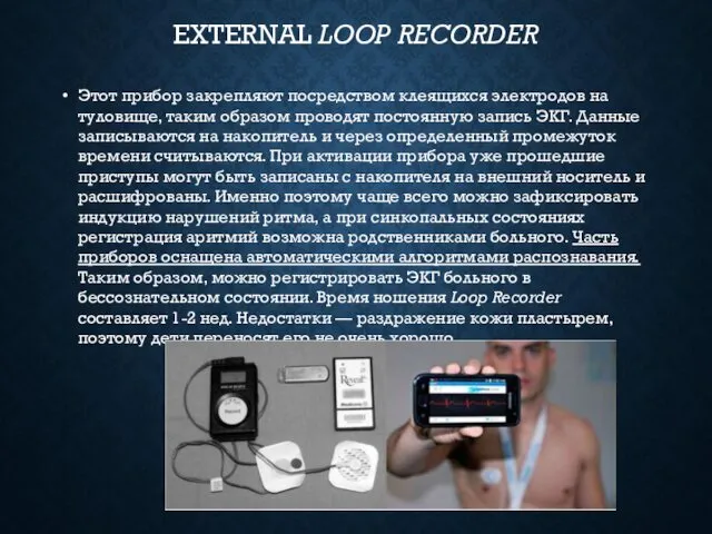 EXTERNAL LOOP RECORDER Этот прибор закрепляют посредством клеящихся электродов на туловище, таким образом