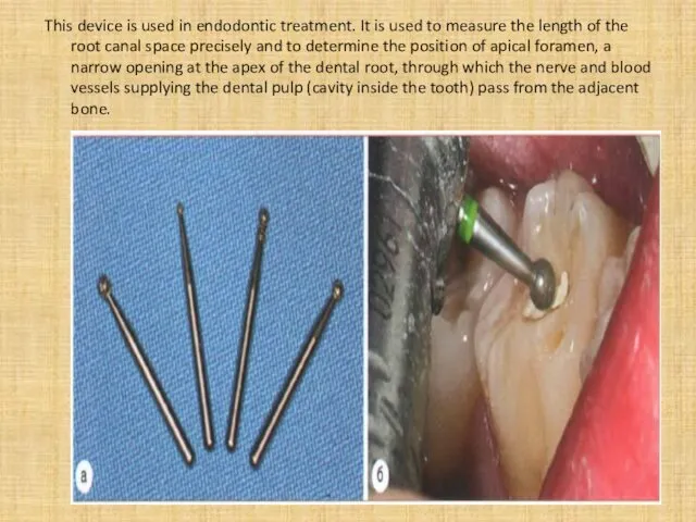 This device is used in endodontic treatment. It is used to measure the