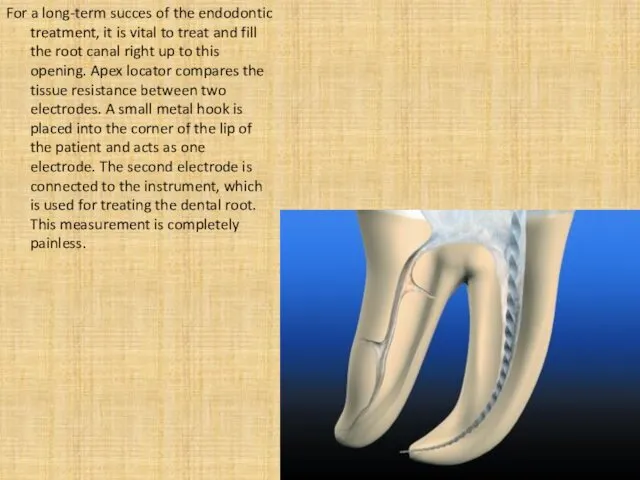 For a long-term succes of the endodontic treatment, it is