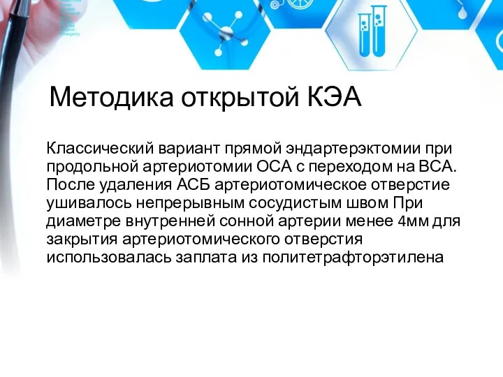 Методика открытой КЭА Классический вариант прямой эндартерэктомии при продольной артериотомии