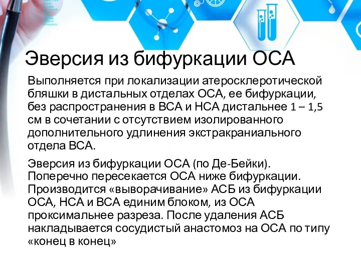 Эверсия из бифуркации ОСА Выполняется при локализации атеросклеротической бляшки в