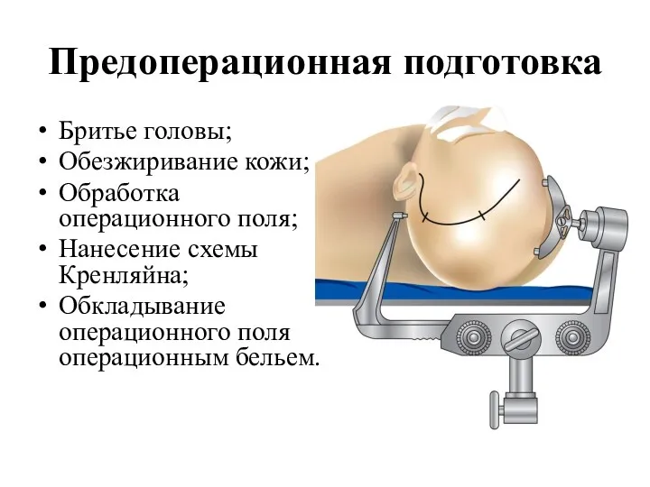Предоперационная подготовка Бритье головы; Обезжиривание кожи; Обработка операционного поля; Нанесение