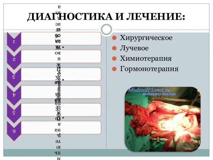 ДИАГНОСТИКА И ЛЕЧЕНИЕ: Хирургическое Лучевое Химиотерапия Гормонотерапия