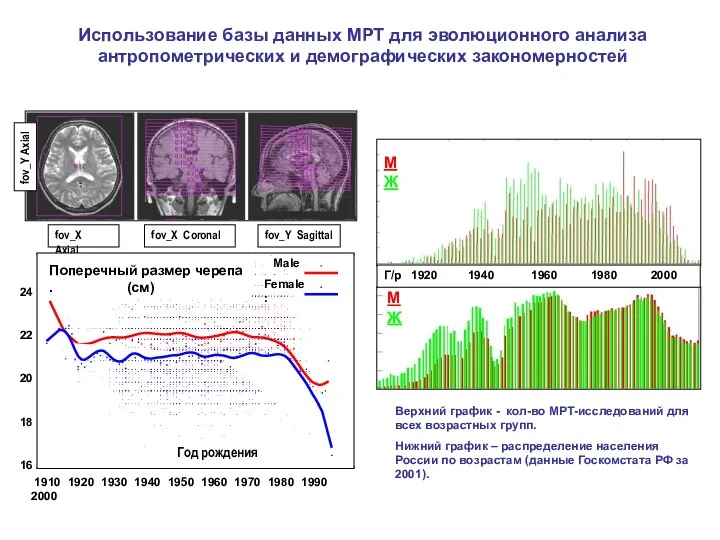 fov_X Axial fov_X Coronal fov_Y Sagittal 24 22 20 18