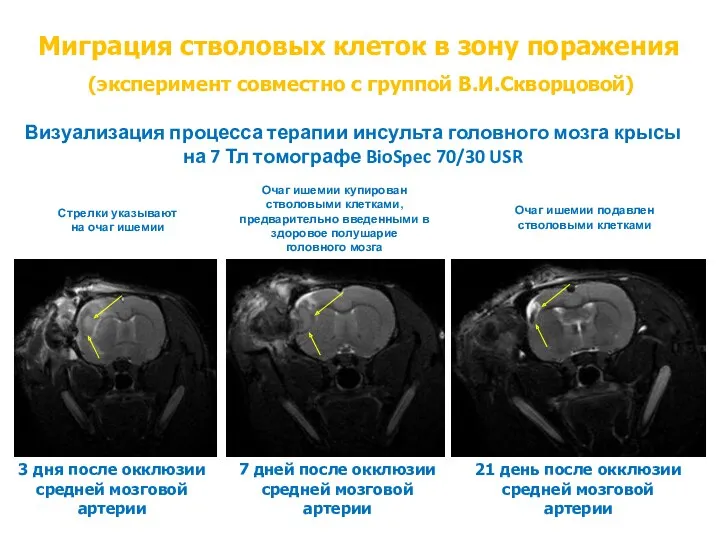 3 дня после окклюзии средней мозговой артерии 7 дней после