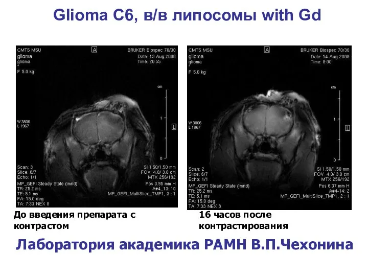 Glioma С6, в/в липосомы with Gd До введения препарата с