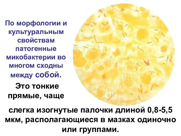 слегка изогнутые палочки длиной 0,8-5,5 мкм, располагающиеся в мазках одиночно