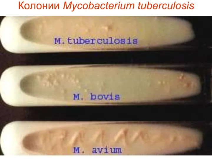 Колонии Mycobacterium tuberculosis