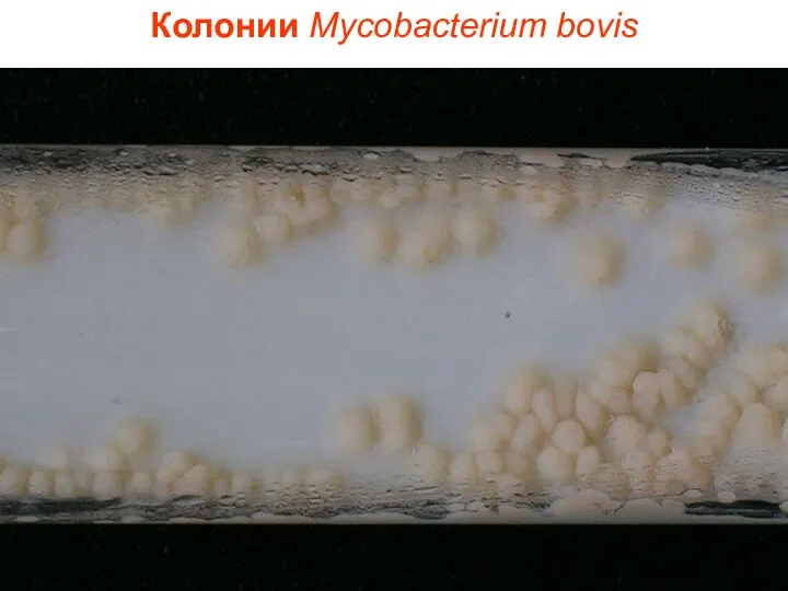 Колонии Mycobacterium bovis