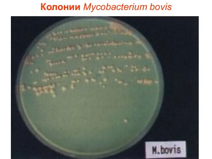 Колонии Mycobacterium bovis