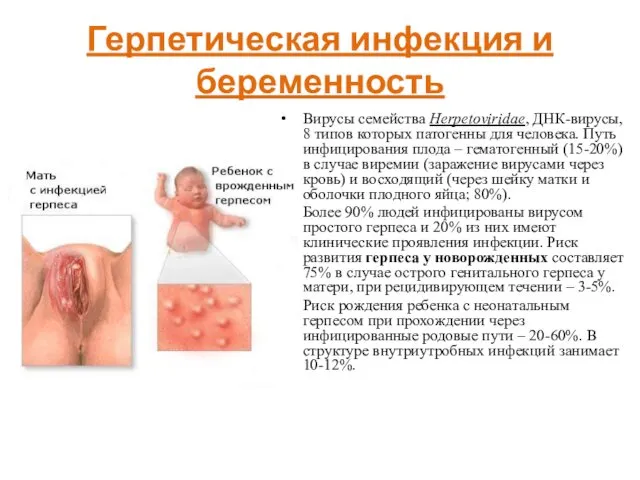 Герпетическая инфекция и беременность Вирусы семейства Herpetoviridae, ДНК-вирусы, 8 типов