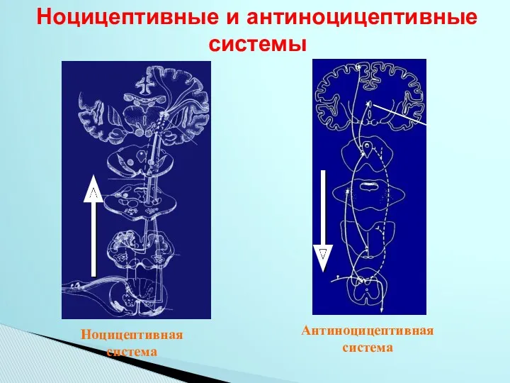 Ноцицептивные и антиноцицептивные системы Антиноцицептивная система Ноцицептивная система