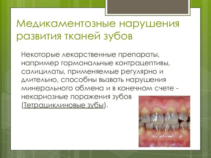 Медикаментозные нарушения развития тканей зубов Некоторые лекарственные препараты, например гормональные контрацептивы, салицилаты, применяемые