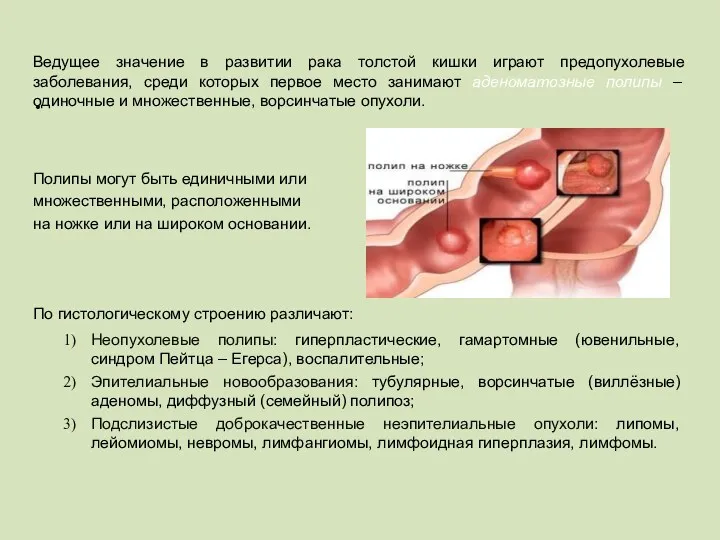 Ведущее значение в развитии рака толстой кишки играют предопухолевые заболевания,